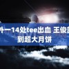 13外一14处tee出血 王俊凯收到超大月饼